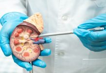 Sağlık sektöründe nefroloji uzmanları, böbrek ve idrar yolu hastalıklarının tanı ve tedavisinde kritik rol oynar. Nefroloji uzmanı, böbrek fonksiyonlarını izleyen, kronik böbrek hastalıklarını teşhis eden ve hastaların yaşam kalitesini artırmak için tedavi planları geliştiren doktordur. Bu uzmanlık alanı, dahiliye ve iç hastalıkları bilgisini böbrek sağlığı ile birleştirir ve hastalara özel çözümler sunar. Konulu bir haber görseli.